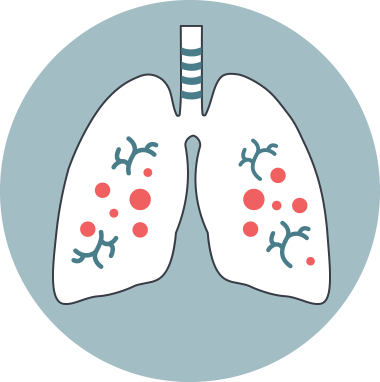 Lungs with adult NTM bacteria