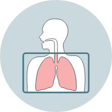 Lung x-ray